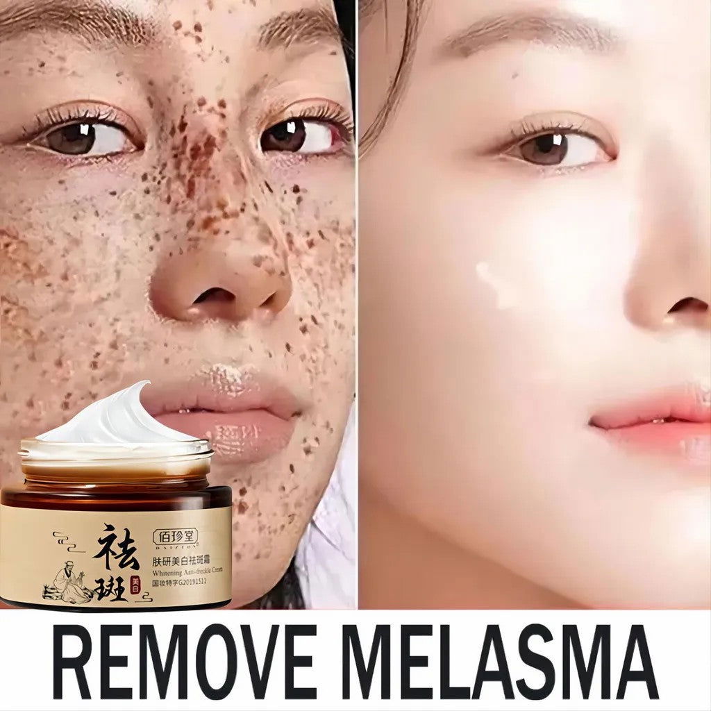 BAIZTON Whitening Anti Freckle Cream (Facial) - China To BD Web