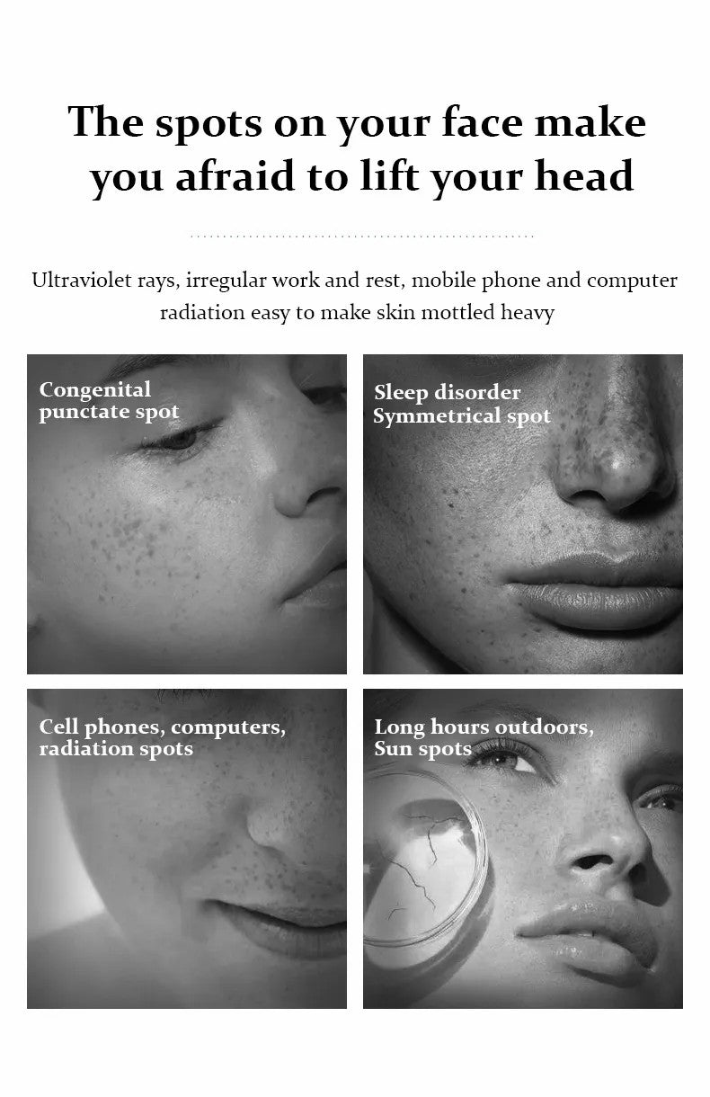 BAIZTON Whitening Anti Freckle Cream (Facial) - China To BD Web