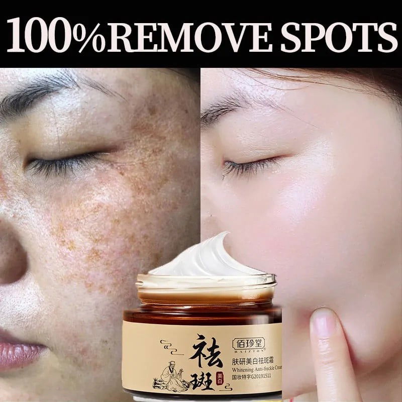 BAIZTON Whitening Anti Freckle Cream (Facial) - China To BD Web