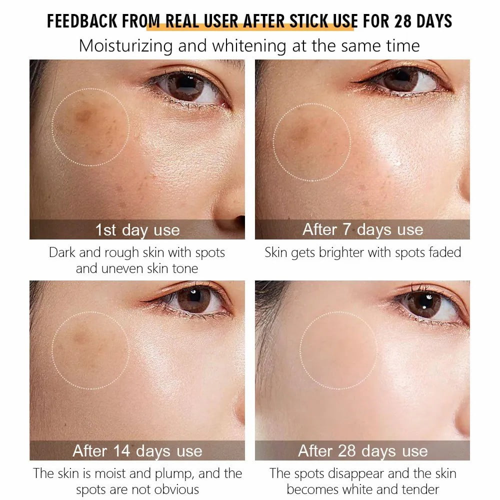 BAIZTON Whitening Anti Freckle Cream (Facial) - China To BD Web
