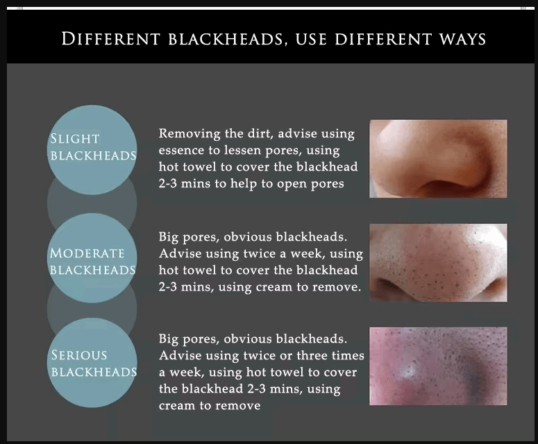 BIOAQUA Deep Cleansing Black Mask - China To BD Web